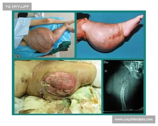 尤文图斯基金会发起募捐支持癌症科研项目